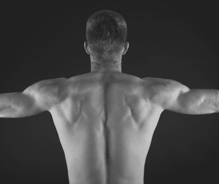 What is Schroth Method? Stroma Physical Therapy